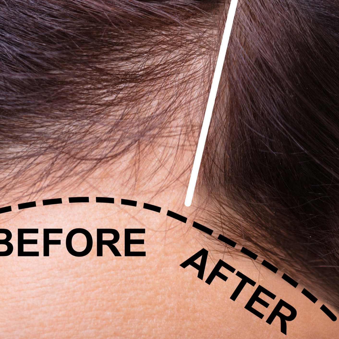 Anti hairfall Serum