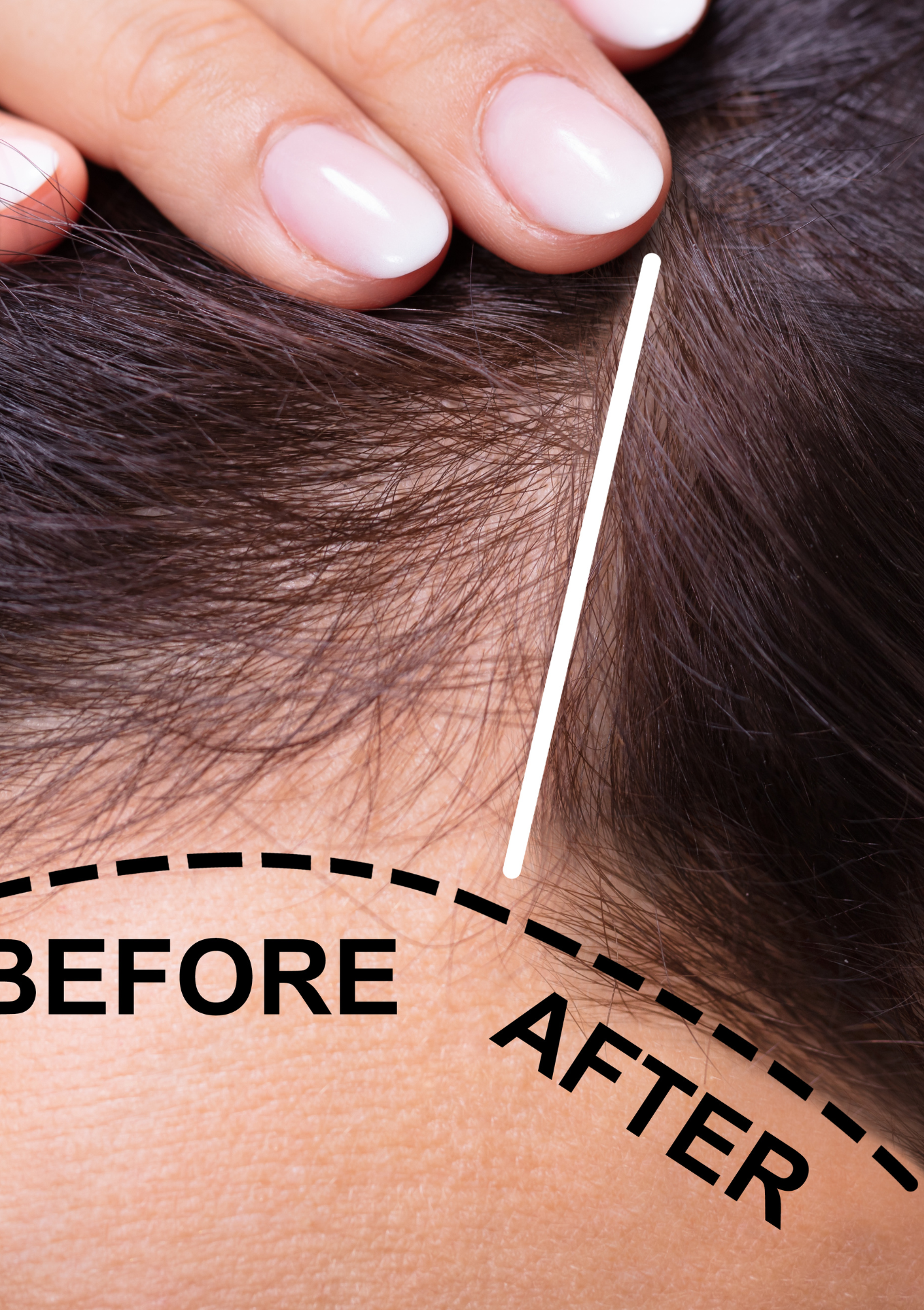 Anti hairfall Shampoo